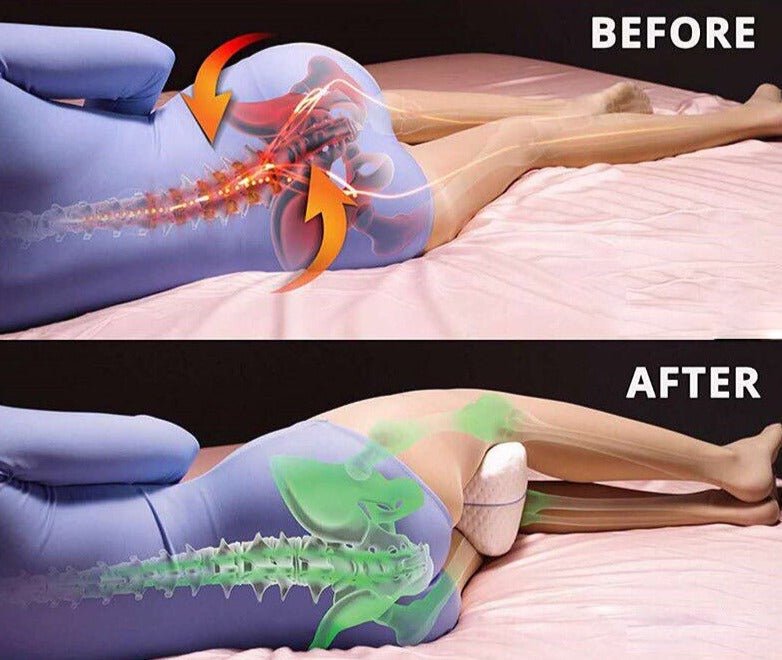 Orthopedisch KneePillow™